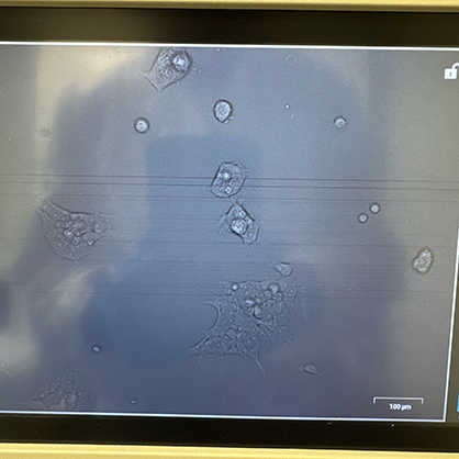 A closer look at the HEK cells
